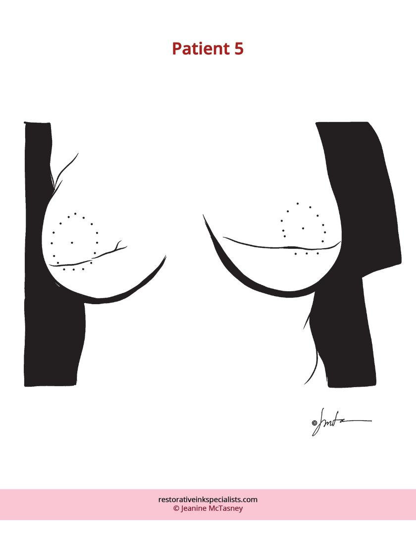Breast Cancer Areola Tattoo Coloring Book
