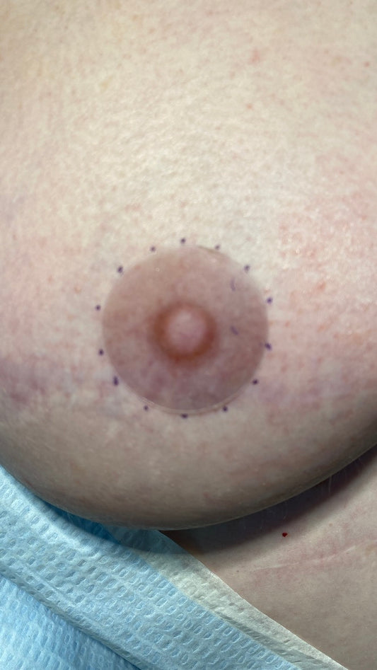 Areola Placement Stickers